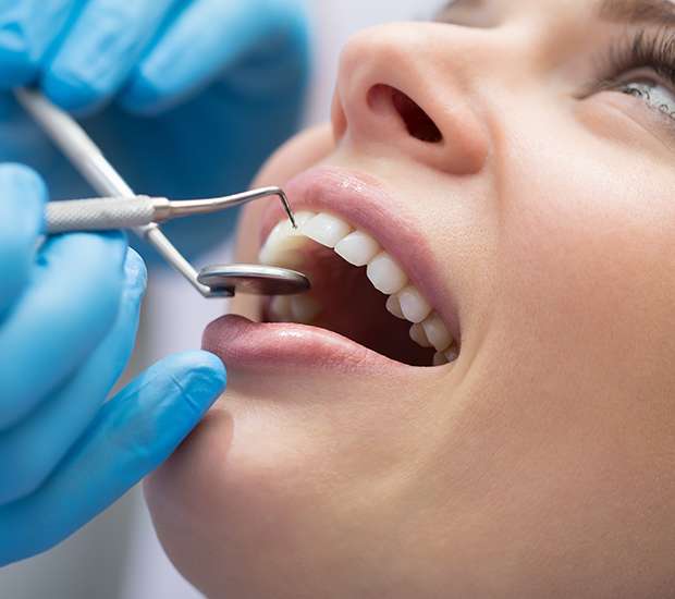 Ashburn Dental Bonding