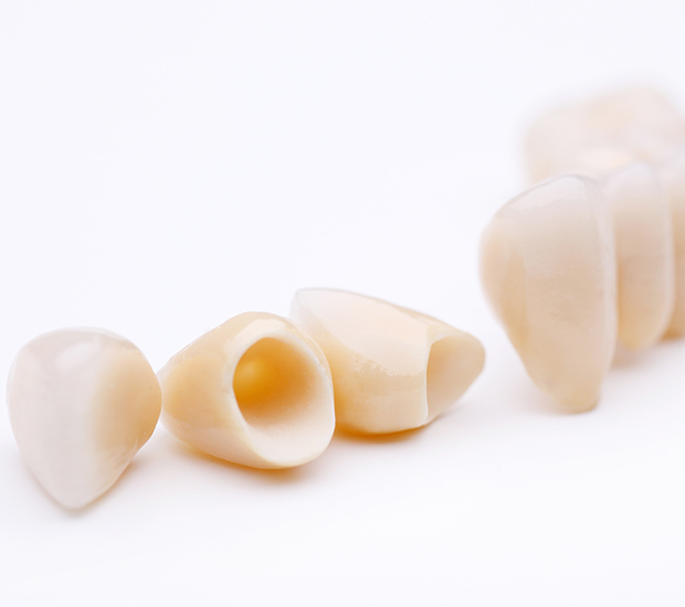 Ashburn Dental Crowns and Dental Bridges