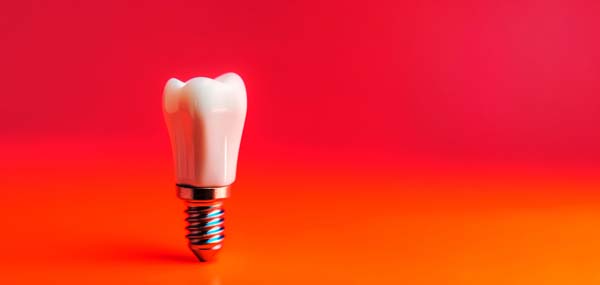 What Are The Advantages Of Getting Dental Implants