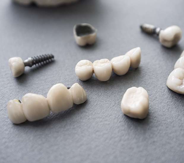 Ashburn The Difference Between Dental Implants and Mini Dental Implants