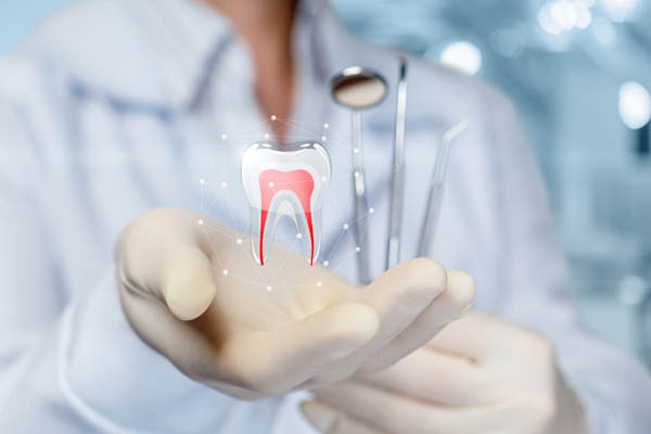 Possible Complications Of Root Canals And How To Avoid Them